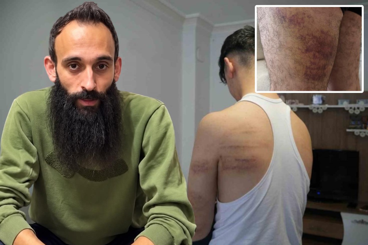 15 yaşındaki çırağa işkencede yeni gelişme! Yeniden gözaltına alınan cani berber tutuklandı