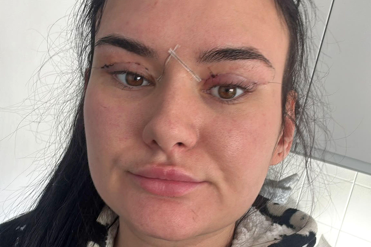 Göz kapağı ameliyatı için yurt dışına gittiler, acil servise düştüler