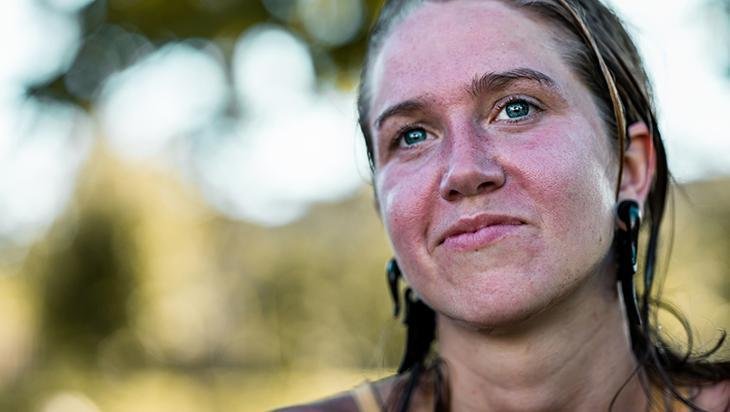 Kış güneşi cildi mahvediyor Herkesin yaptığı hata, kuruluğa ve tahrişe neden oluyor Kış güneşi cildi mahvediyor Herkesin yaptığı hata, kuruluğa ve tahrişe neden oluyor