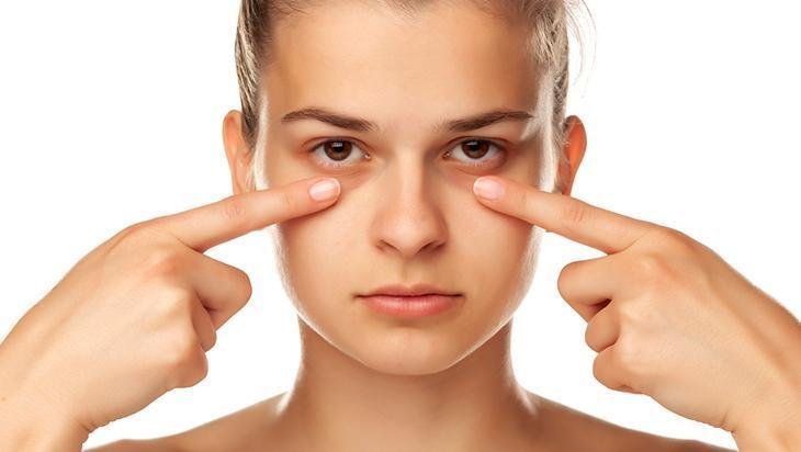 Göz altı halkaları tarih olacak Pahalı kremler çöpe, doğal iksir poşetin içinde Göz altı halkaları tarih olacak Pahalı kremler çöpe, doğal iksir poşetin içinde