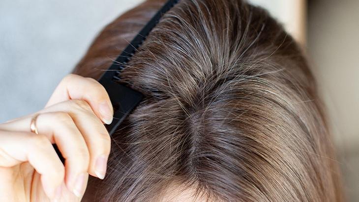 Saçlara en iyisi ama yüze bulaşırsa felaket Meğer sivilceleri besliyormuş