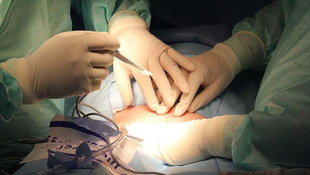 TBMM de kabul edildi: organ bağışı süreçlerinde dönüşüm başlıyor! e-Devlet üzerinden organ bağışı dönemi geliyor: Bağışçıların yakınlarına öncelik tanınacak... 3