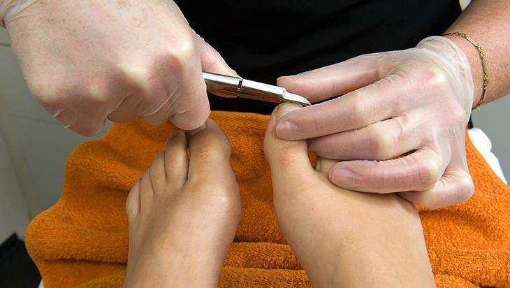 Ayak bakımı deyip geçmeyin, enfeksiyon riski hat safhada Sinyali buymuş