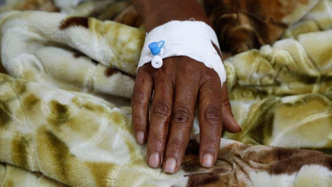 Kolera salgını alarmı! Yüzlerce vaka bildirildi: 13 kişi hayatını kaybetti!  3