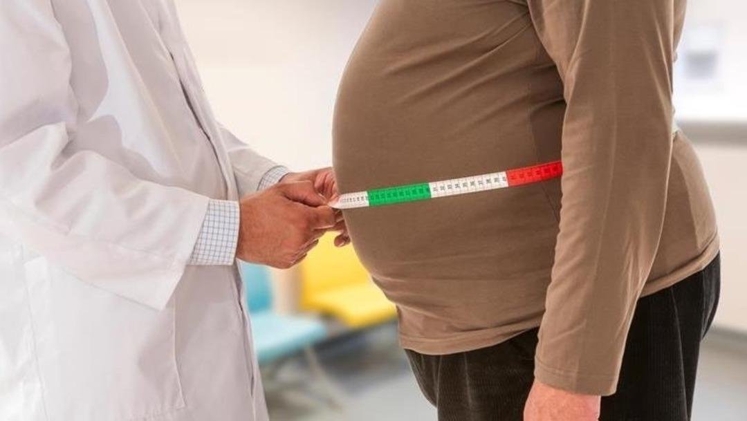 ‘Obezite ömrü 10 yıl kısaltıyor’ uyarısı! Uzmanlar: 