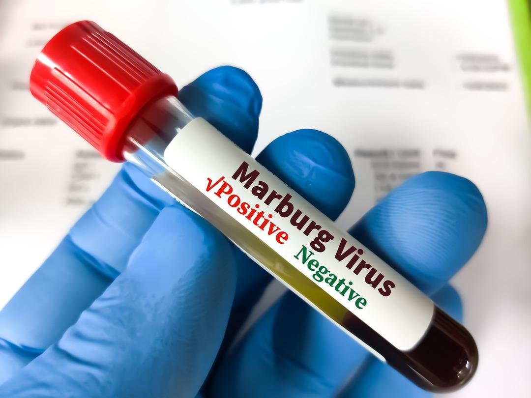 Korkunç hastalık: Resmen içerden çürütüyor! Ebola benzeri virüs 8 kişinin canını aldı 3