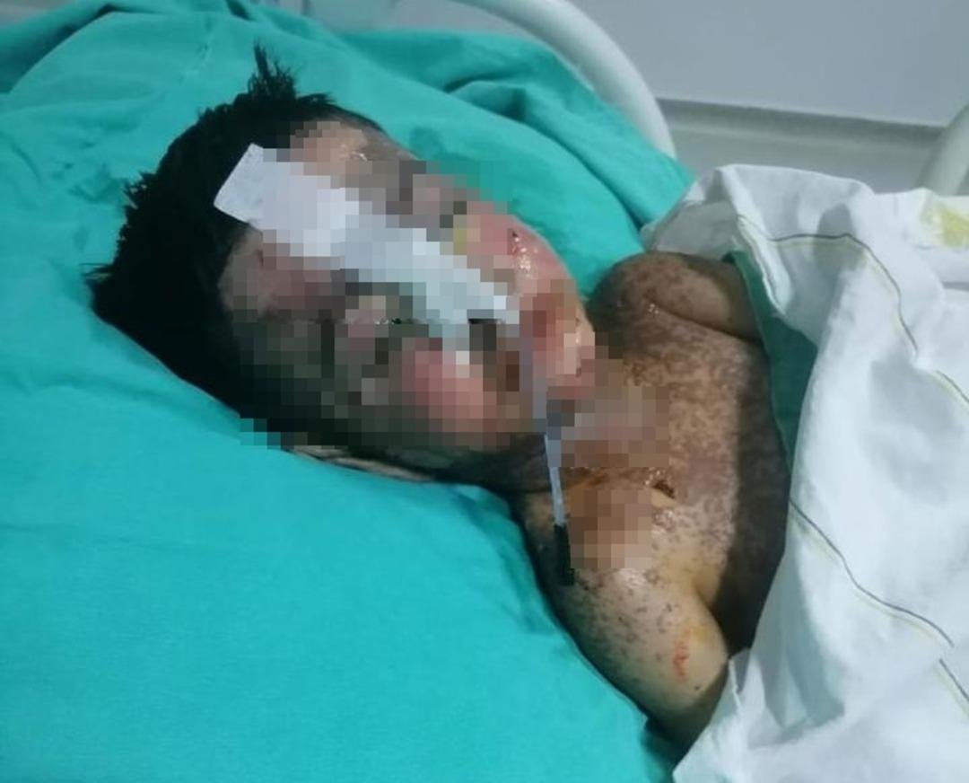 3 yıl sonra ortaya çıktı: 18 santimlik katerer unutmuşlar! Salatalık yutunca ortaya çıktı 5