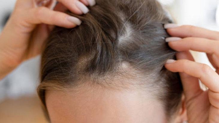 İpek gibi saçların altın kuralını açıkladı Az yıkayınca uzması tamamen efsane İpek gibi saçların altın kuralını açıkladı Az yıkayınca uzması tamamen efsane