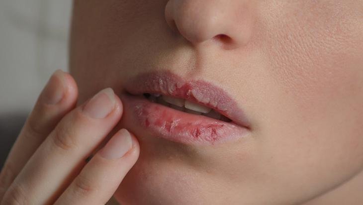 Kendi dudak yağınızı hazırlayın Yumuşatıp bebek gibi yapan formül