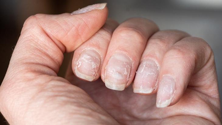 Tırnakları güçlendirip etleri nemlendiriyor 4 malzemeli basit karışım Tırnakları güçlendirip etleri nemlendiriyor 4 malzemeli basit karışım